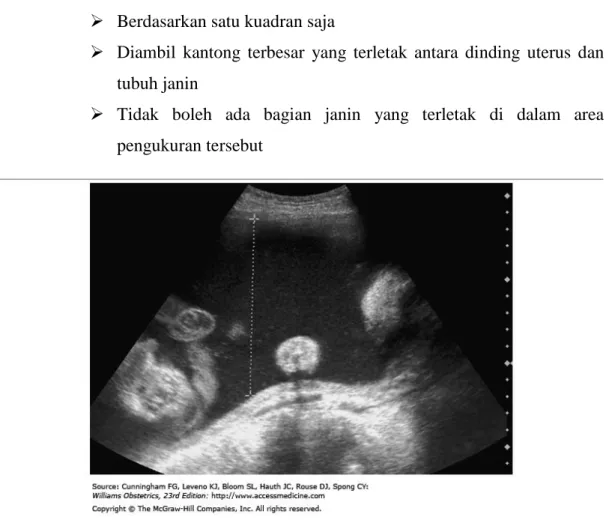 Gambar  9  :  Gambar  di  atas  adalah  contoh  pengukuran  secara  single  pocket,  dimana  yang  diukur  adalah  jarak  vertical  terjauh  antara  bagian  janin  dan  dinding  uterus,  dan  tidak  ada  bagian  janin  yang  terletak  dalam  area  pengukur