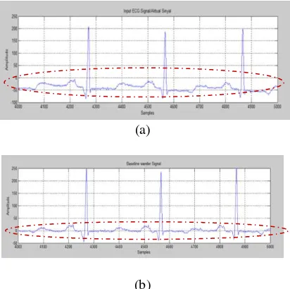 Gambar 3.1. Sinyal ECG Asli untuk Data 100m.mat(a) dan Sinyal ECG Hasil Wander RemovalBaseline (b) 