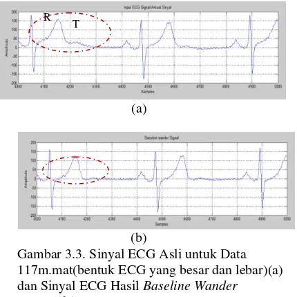 Gambar 3.3. Sinyal ECG Asli untuk Data 