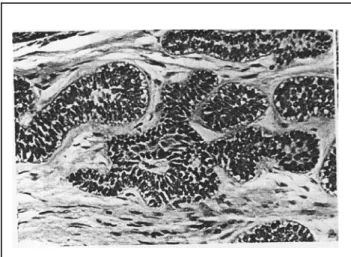 Gambar 8: Tipe sel basal (Sapp JP, Eversole LR, Wysocki  GP.  Contemporary Oral and Maxillofacial Pathology