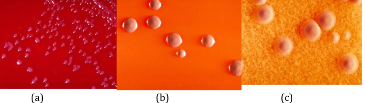 Gambar 7. Pembiakan bakteri difteri dengan (a) agar darah; (b) McLoed’s agar plate  culture; (c) Cystine tellurite plate culture 