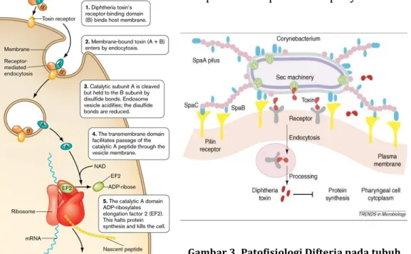 Gambar 3.  Patofisiologi Difteria pada tubuh 
