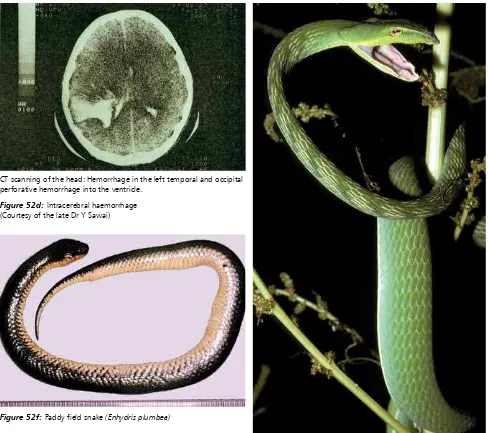 Figure 52f: Paddy field snake (Enhydris plumbea)