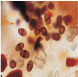 Gambar 2. Bentuk konidia dewasa dari fungi Lasiodiplodia sp.