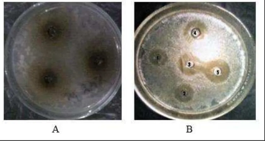Gambar 1. Contoh Aktivitas Antibakteri Infusa Daun Lidah Buaya (A) Menghambat