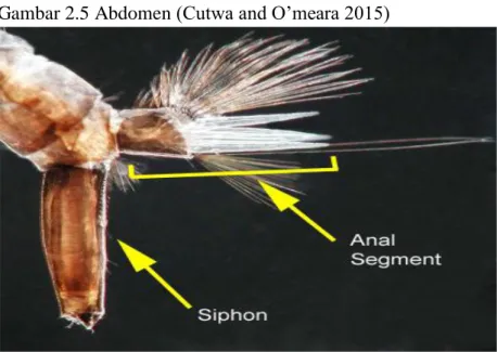 Gambar 2.7 Siphon (Cutwa and O’meara, 2015) 