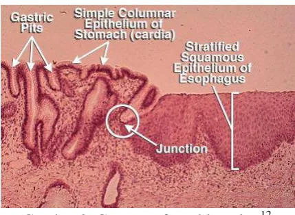 Gambar 2. Gastroesofageal junction12 