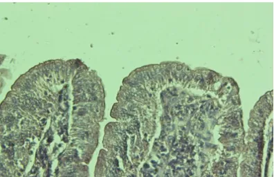 Gambar 2. Skor 1 : epitel mukosa duodenum normal (400x)
