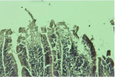 Gambar 4. Skor 3: erosi epitel mukosa duodenum (400x)