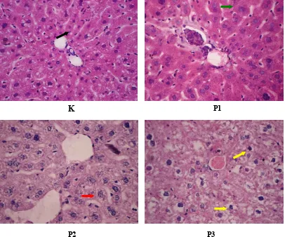 Gambar 1. Gambaran histopatologi hepar tikus Wistar (400x). (  ) : sel hepar normal. (  ) : degenerasi parenkimatosa sel hepar.(  ) : degenerasi hidropik sel hepar