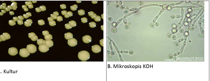 Gambar 2.14: A. Gambaran Kultur Candida albicans dan  B. Gambaran Mikroskopis KOH Candida albicans