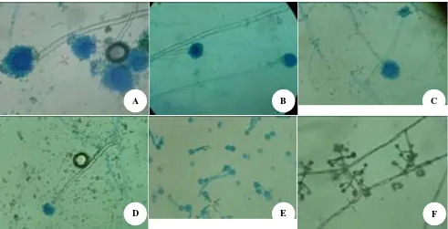 Gambar 1. Hasil identifikasi fungi dalam lumpur aktif Proses Terpadu: (A) Aspergillus niger, (B)
