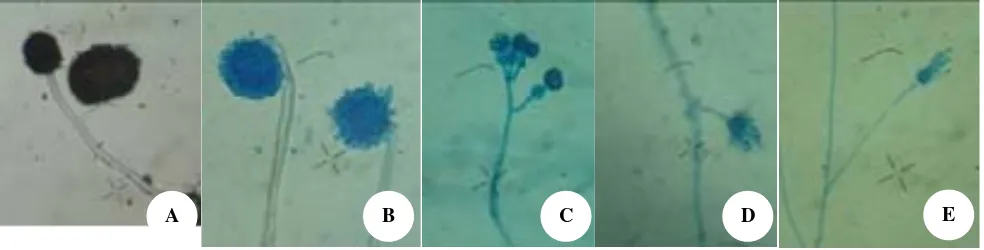 Gambar 3. Hasil identifikasi fungi dalam lumpur aktif Proses Finishing: (A). Aspergillus niger, (B)