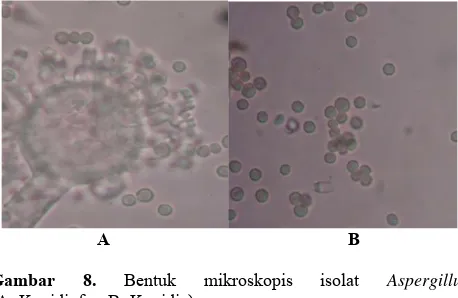 Gambar 4. Bentuk mikroskopis isolat Metarhizium.Keterangan: A=Konidiofor, B=Konidia  