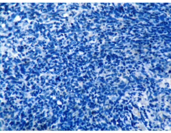 Gambar 12. Pewarnaan immunohistokimia TNF- αskor 0 (negatif)pada  jaringan KNF dengan pembesaran x400 