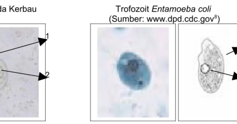 Gambar   4   Perbandingan   Foto   Protozoa   pada   Tinja   Kerbau   dengan   Trofozoit  Entamoeba