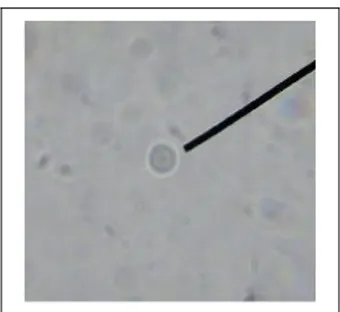 Gambar   5f   Perbandingan   Foto   Protozoa   pada   Tinja   Domba   dengan   Genus  Cryptosporidium