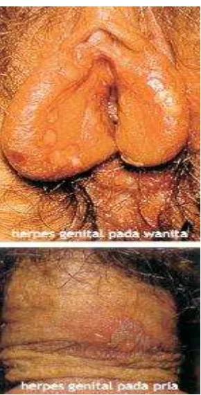 Gambar 5. Hepers Genitalis 