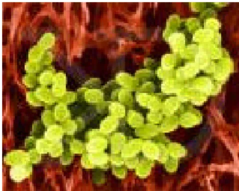 Gambar 1.  Bakteri Staphylococcus aureus 