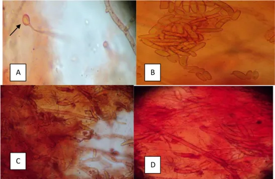 Gambar  8.  Morfologi  koloni  jamur  penyebab  busuk  umbi  porang  (200  X):A)  miselium  dengan   klamidospora (terminal); B,C,D) miselium dengan mikro dan makrokonidia 