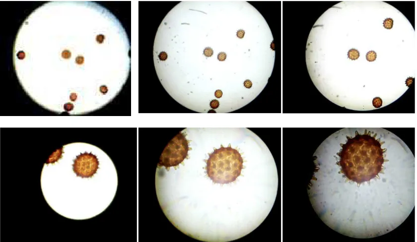 Figure 2. Digital microscope in simple mode. (a) Object image appears on the screen monitor, (b) Image of the Arachis hypogaea Caulis captured using the digital microscope in simple mode 