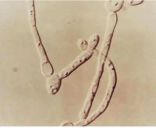 Gambar 3. Pseudohifa & blastokonidia pada pengecatan Gram KVV 