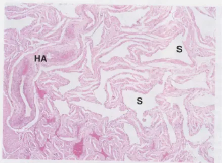 Gambar 2.6 Jaringan Erektil Penis, HA: arteri helicinae, S: sinus vaskular (dikutip  dari Young and Heath, 2000) 
