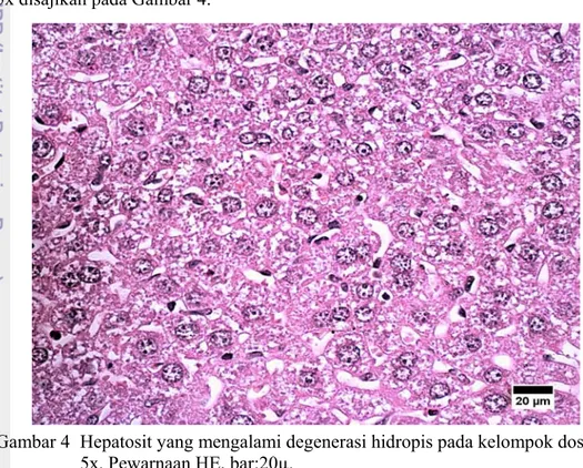 Gambar 4  Hepatosit yang mengalami degenerasi hidropis pada kelompok dosis  5x. Pewarnaan HE, bar:20µ