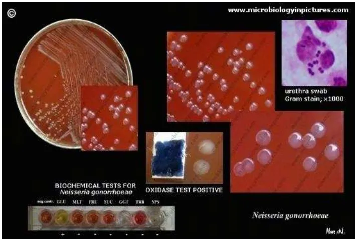 Gambar 3. Koloni Neisseria gonorrhoeae pada media Thayer Martin29