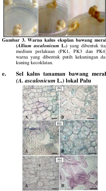 Gambar 6.  Rata-rata lebar sel kalus bawang merah (A. ascalonicum L.) pada masing- masing perlakuan yang di cobakan