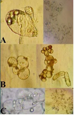Gambar 4.Pengamatan sel kalus eksplan tanaman anggur hijau (V. vinifera L.).  