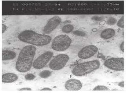Gambar 5. Porphyromonas gingivalis pada mikroskop elektron dengan 