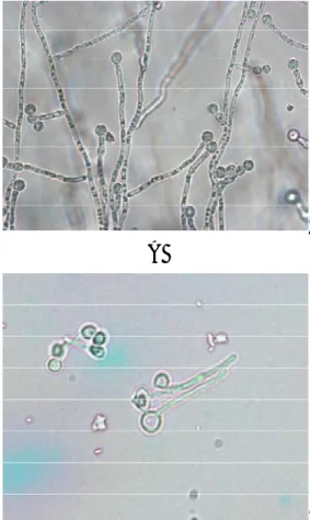 Gambar  2.1.  Candida  albicans.  :  A.  Bentuk  klamidospora  pada  cornmeal  agar.  B