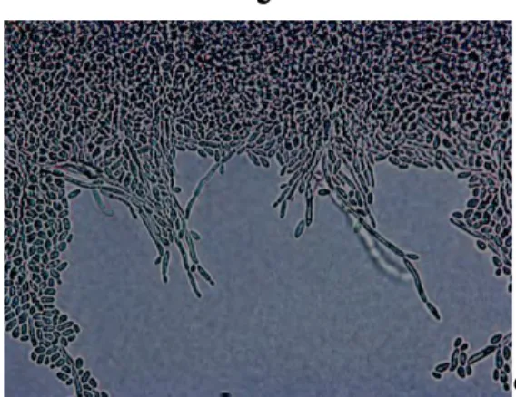 Gambar 2.3. Mikroskopis dari Candida keyfr pada agar cornmeal   ditemukan blastospora dan pseudohifa  14 
