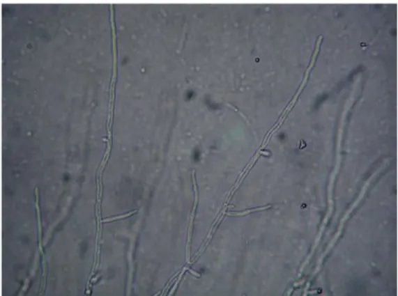 Gambar 2.5. Mikroskopis dari Candida tropicalis pada agar cornmeal  14
