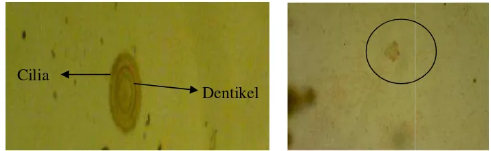 Gambar 4.6.TrichodiNaCl 0.85%chodina sp. yang menginfeksi ikan mujair (perbeCl 0.85%).perbesaran 400x dalam