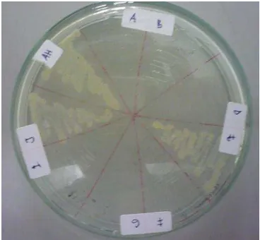 Gambar. Uji sensitifitas ampisilin isolat bakteri air kolam budidaya sampel A, B, D, E, G, I, dan J bakteri A