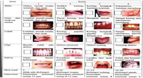 Gambar 1.  Beck Oral Assessment Scale (BOAS)  (Sumber: GKM RSUP Sanglah Denpasar 2013) 
