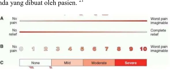 Gambar 1. Visual Analouge Scale (VAS) 