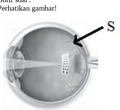 gambar yang ditunjukkan pada soal adalah mata. Bagian yang ditunjuk tanda panahadalah bagian retina mata