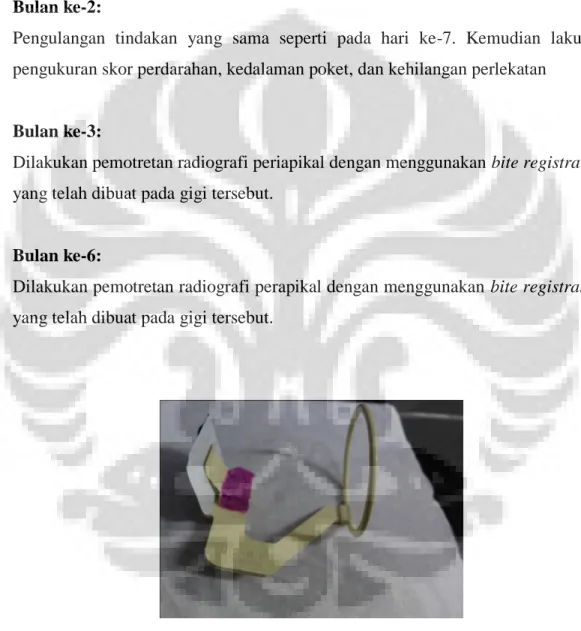 Gambar 4.2 Cone indikator dan catatan gigit 