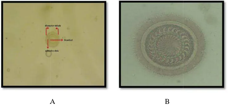 Gambar 4.5.Trichodichodina