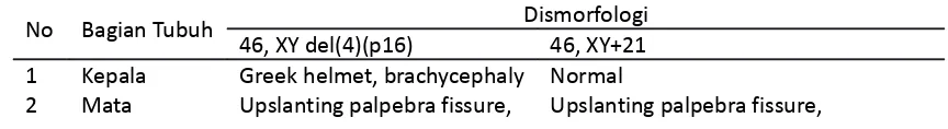 Tabel 11. Hasil pemeriksaan dismorfologi ekstrimitas bawah.