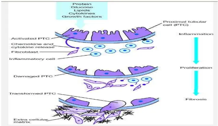 Gambar 2. Patogenesis tubulointersisial 