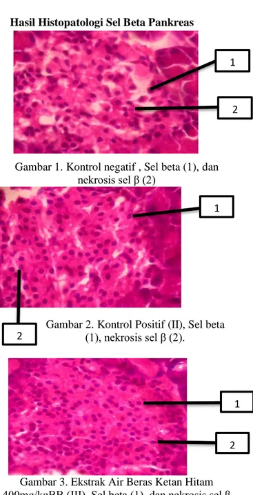 Gambar 1. Kontrol negatif , Sel beta (1), dan  nekrosis sel β (2) 