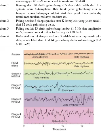 Gambar 2. Gambaran  electroencephalography (EEG) tidur normal. Dikutip dari Lumbantobing,200813 