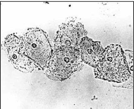 Gambar 1. Gambaran clue cellsdengan pengecatan salin