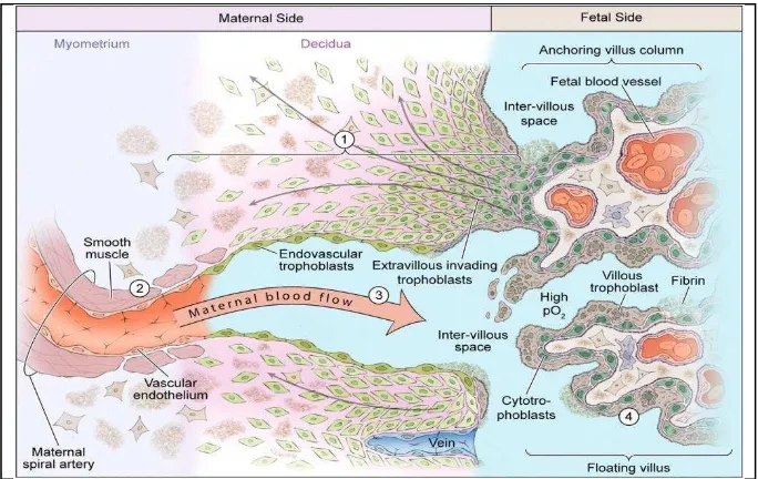 Gambar 3. Remodeling vaskuler pada kehamilan normal dan preeklampsia23 