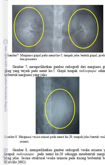 Gambar 7, memperlihatkan gambar radiografi dari marginasi ginjal 