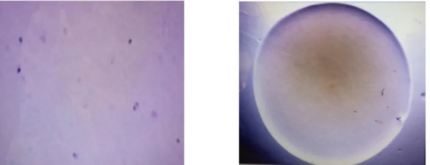 Gambar 1. (a) Sel bakteri setelah cat gram, (b) bentuk koloni bakteri 